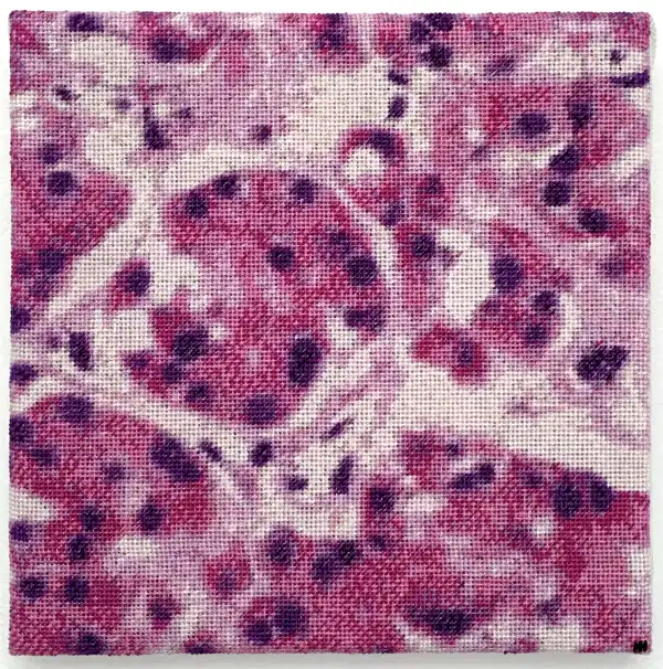 Cellules oncocytaires